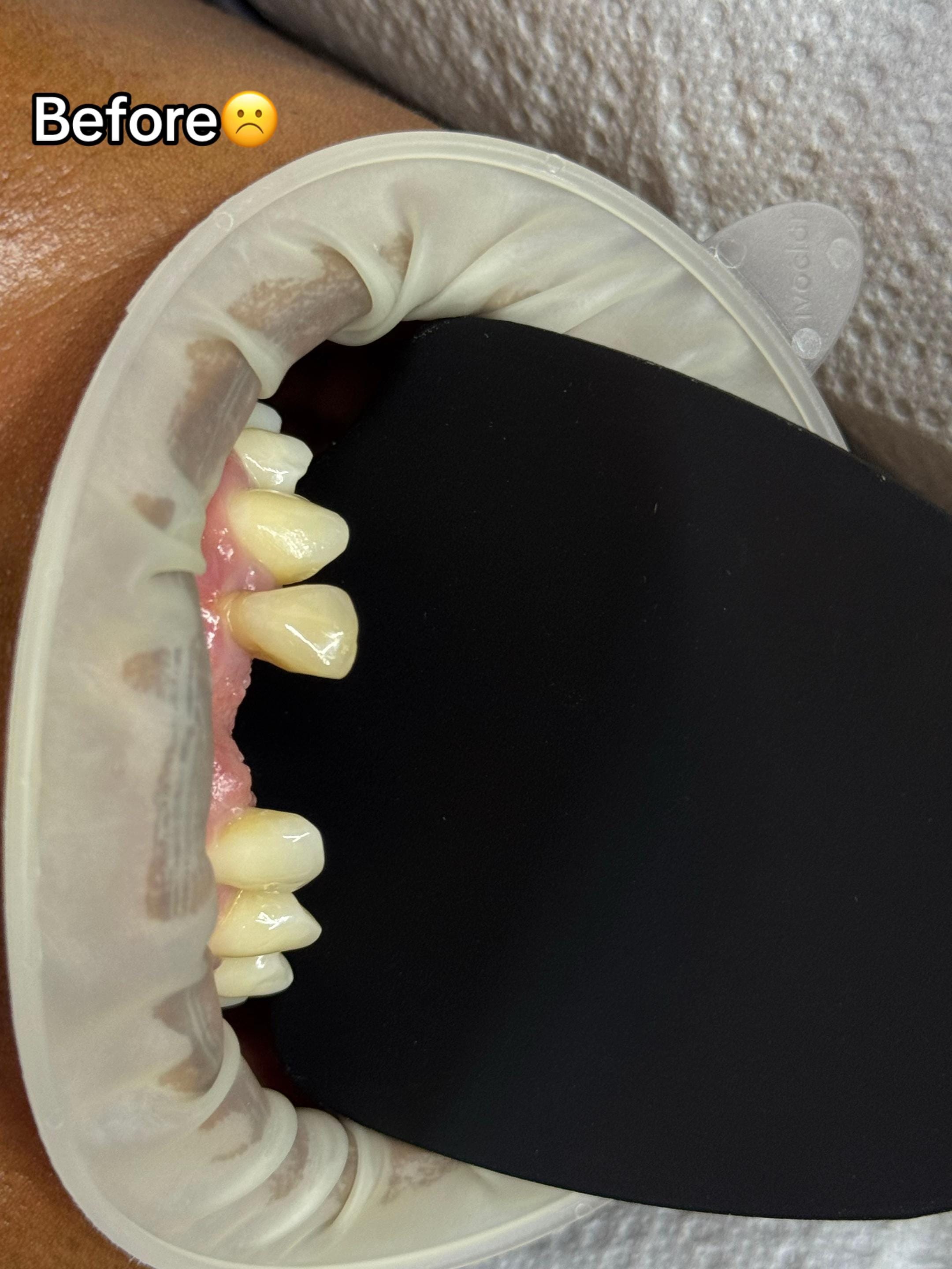 Post 2 by Grace Dental Suite on TikTok (video)
