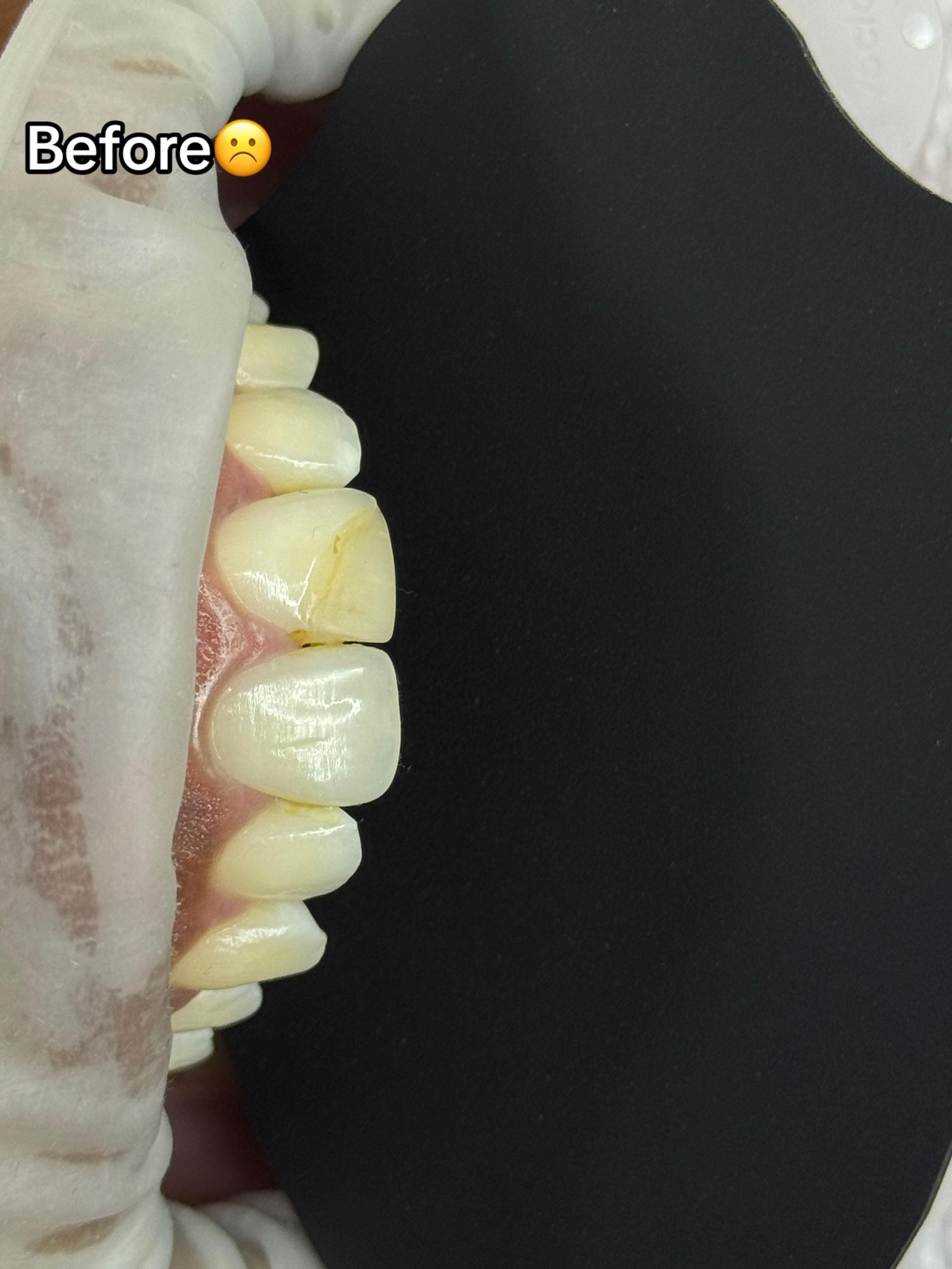 Post 10 by Grace Dental Suite on TikTok (video)