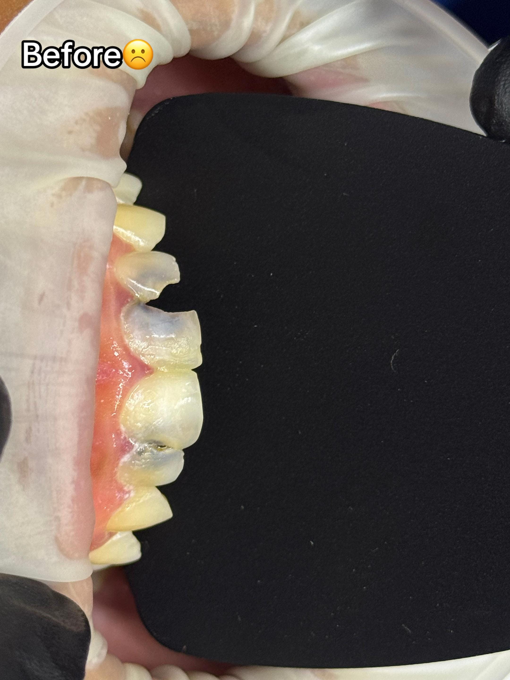 Post 6 by Grace Dental Suite on TikTok (video)