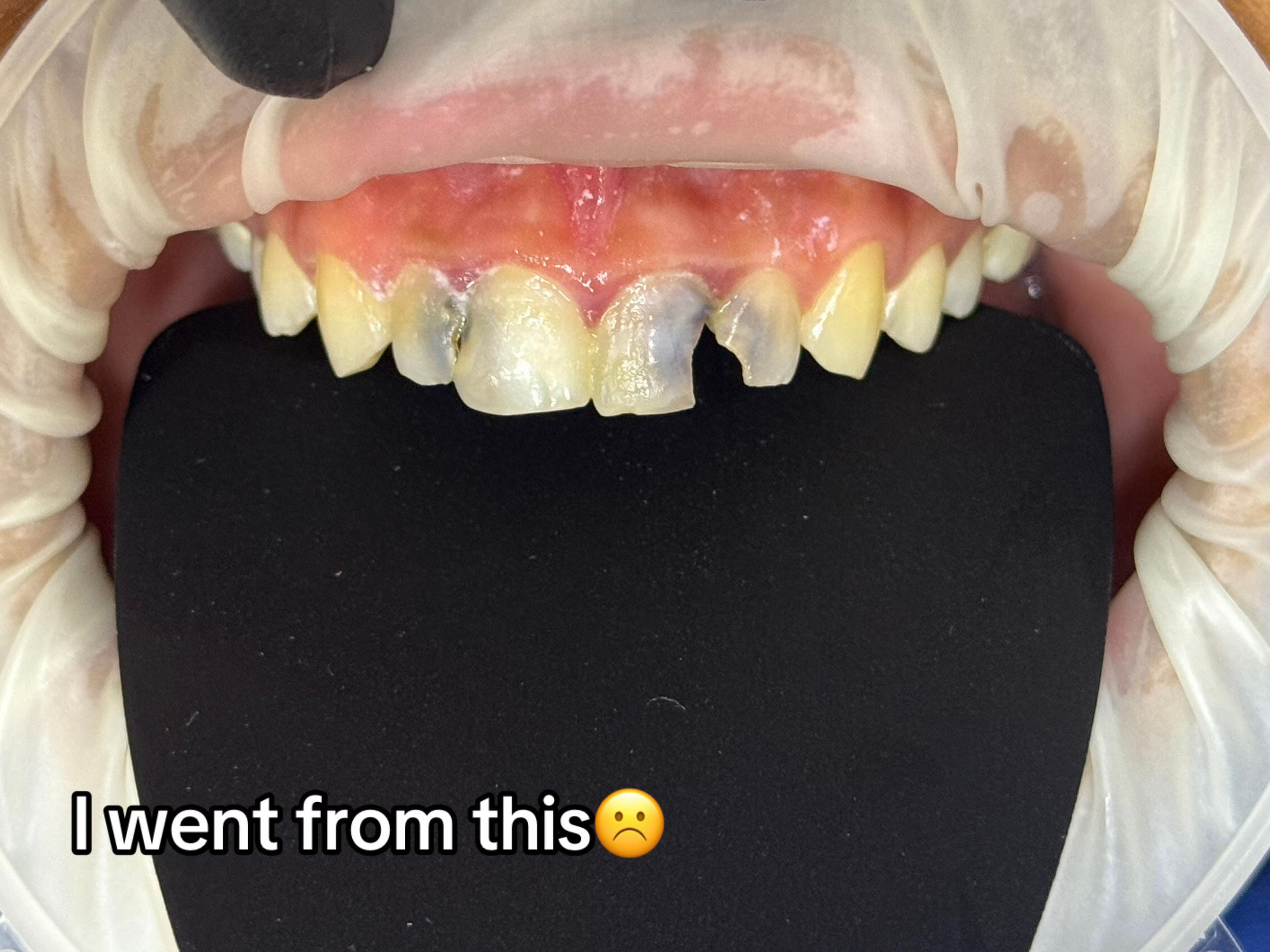 Post 5 by Grace Dental Suite on TikTok (video)