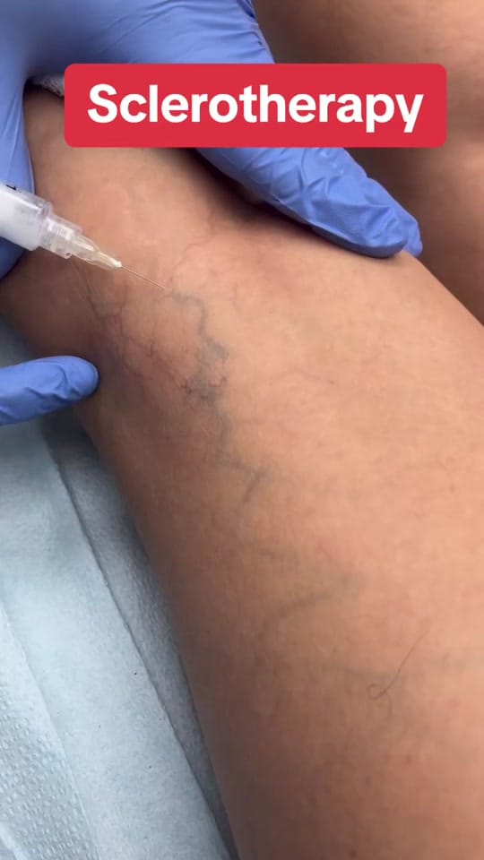 Post 9 by J. Michael Leary, MD on TikTok (video)