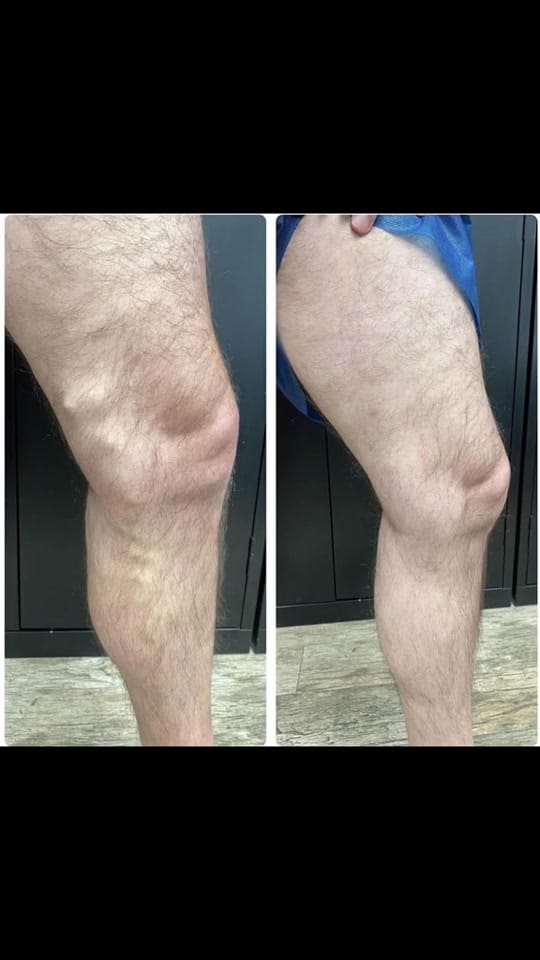 Post 5 by J. Michael Leary, MD on TikTok (video)
