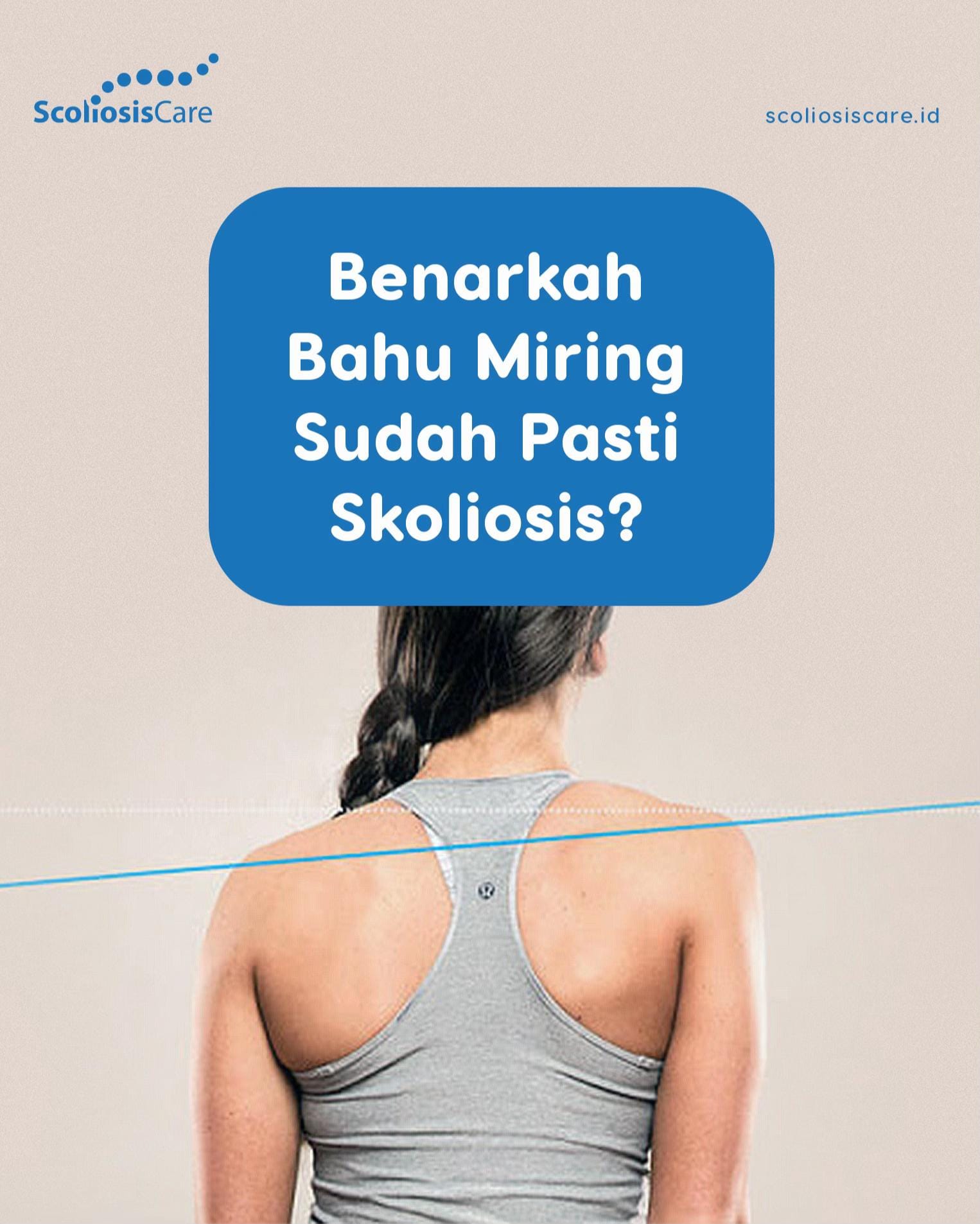 Post 7 by Scoliosis Care on TikTok (video)