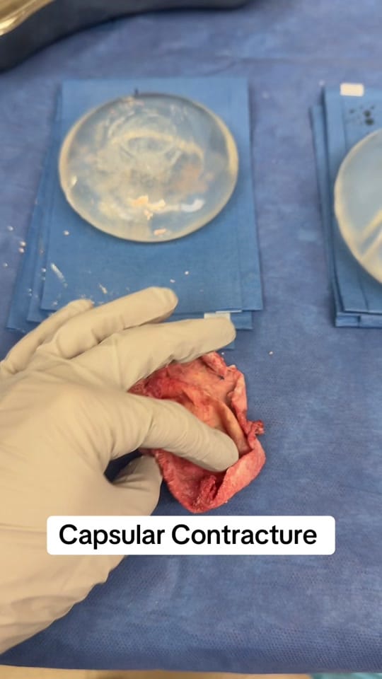 Post 2 by Dr Megan | Plastic Surgeon on TikTok (video)