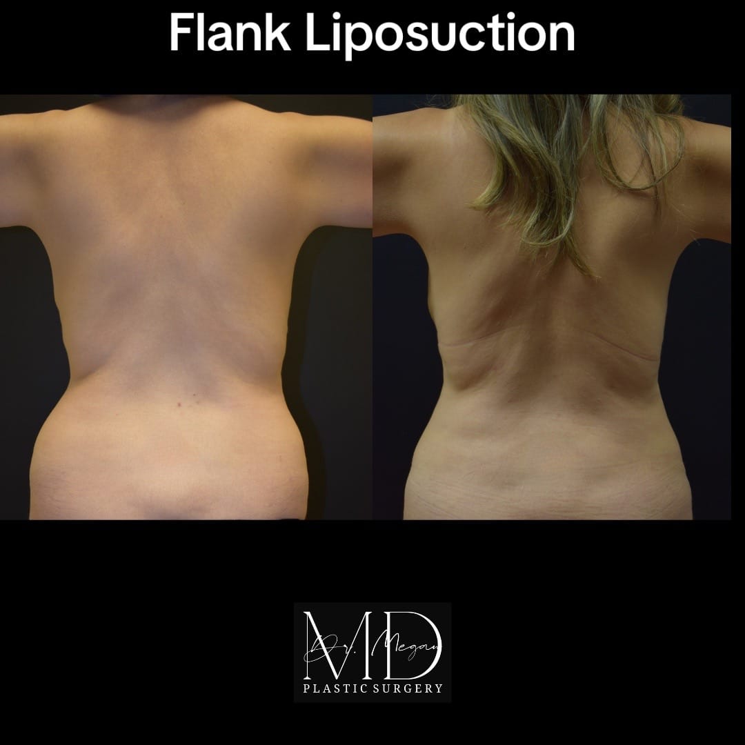 Post 10 by Dr Megan | Plastic Surgeon on TikTok (video)