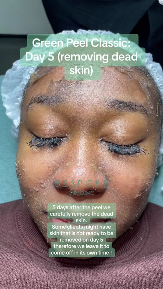 Post 8 by BSC on TikTok (video)