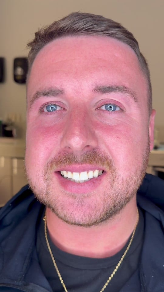 Post 3 by Dentalexcellenceuk on TikTok (video)