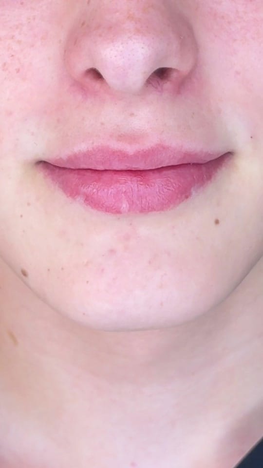 Post 7 by Dentalexcellenceuk on TikTok (video)