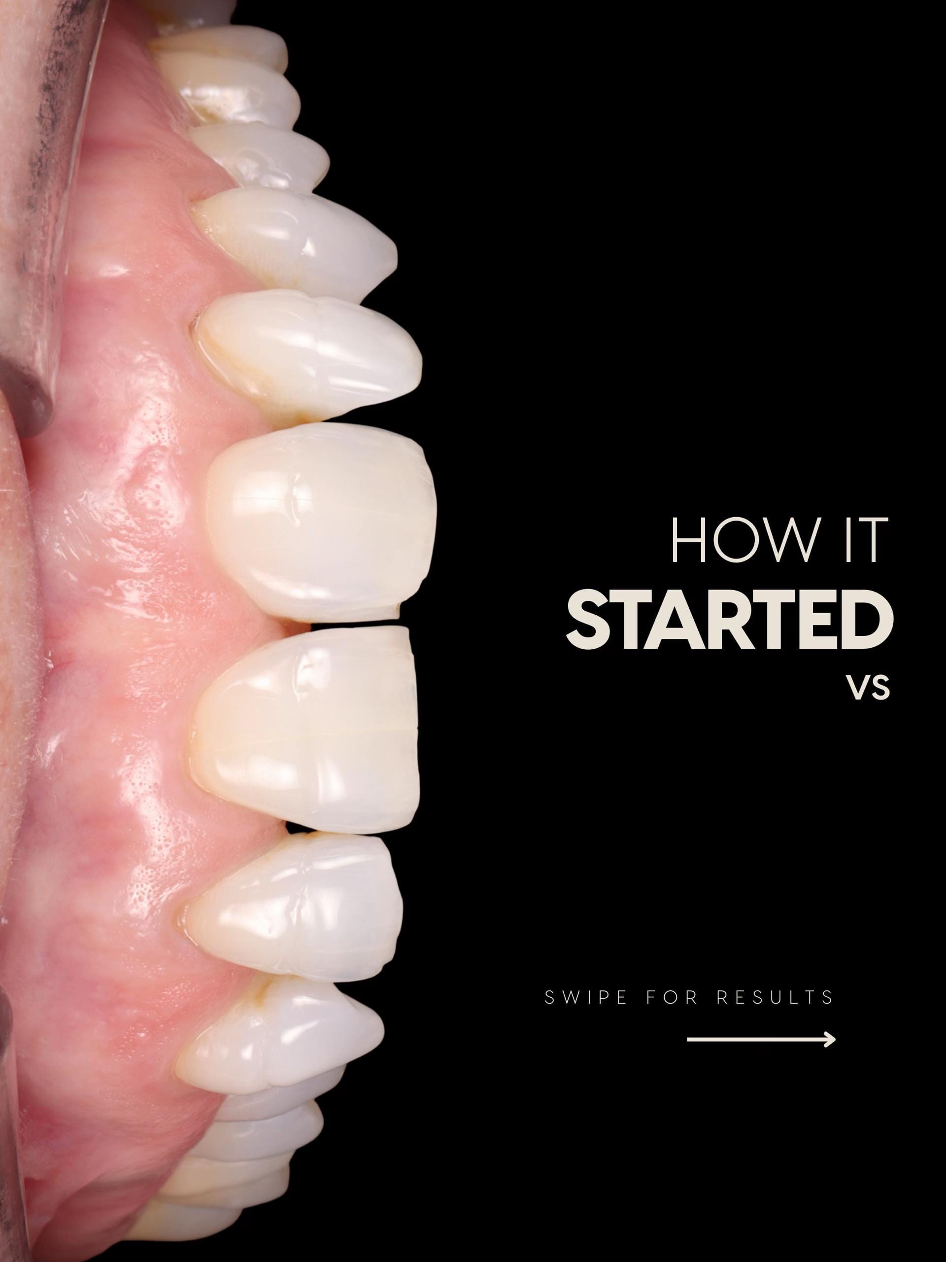 Post 5 by Dentalexcellenceuk on TikTok (video)