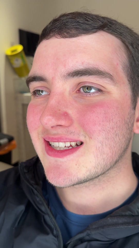 Post 2 by Dentalexcellenceuk on TikTok (video)