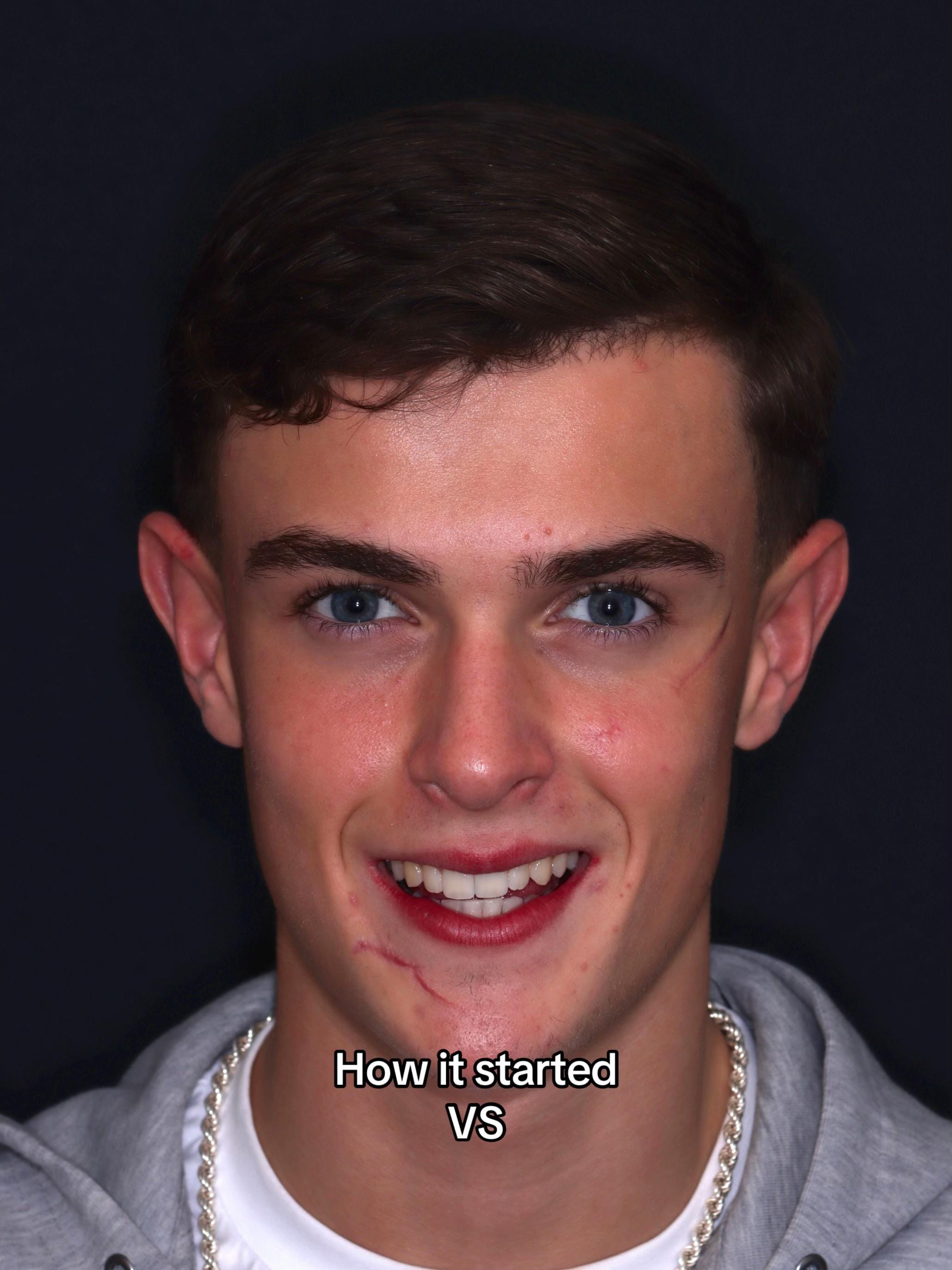 Post 8 by Dentalexcellenceuk on TikTok (video)