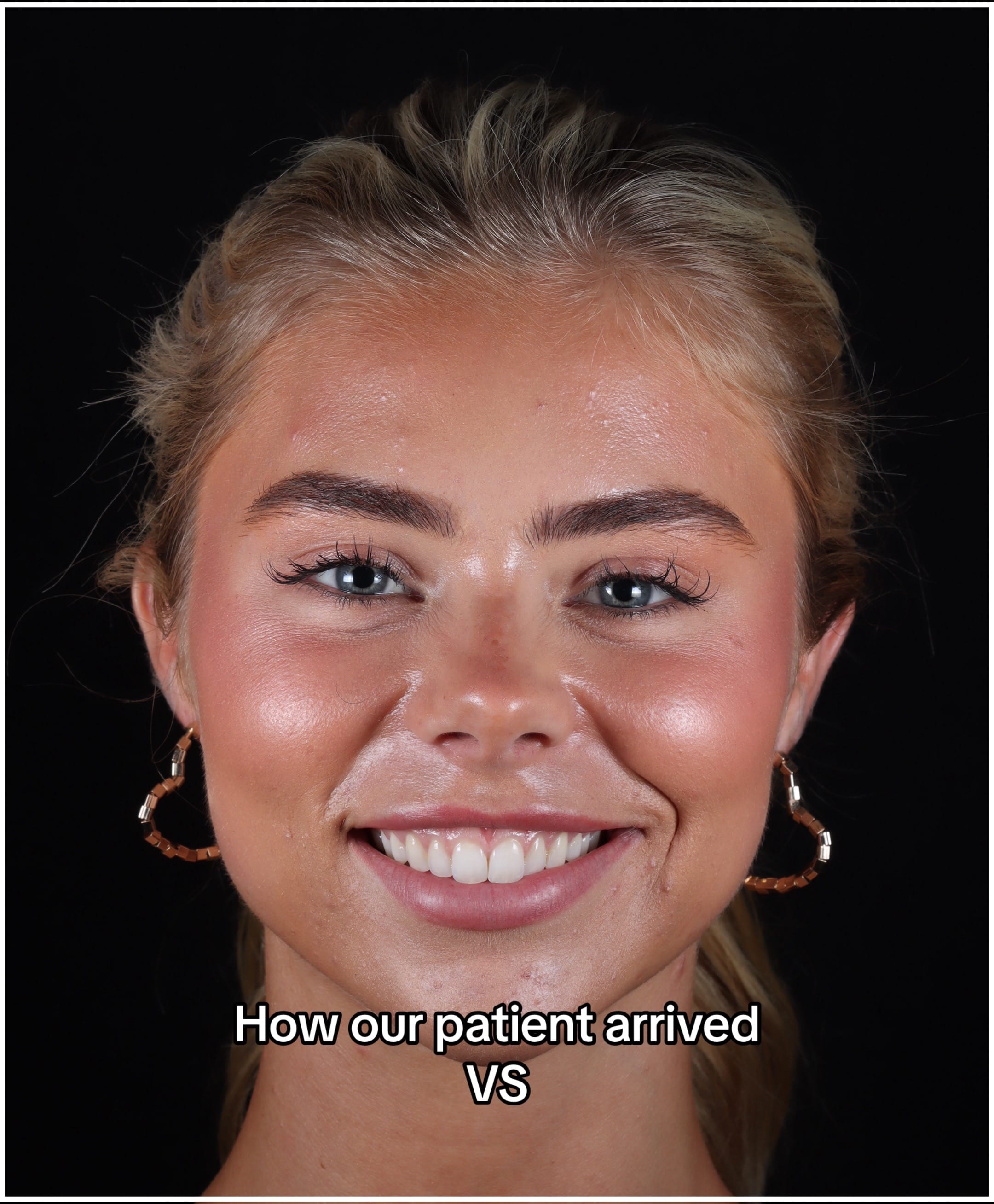 Post 9 by Dentalexcellenceuk on TikTok (video)