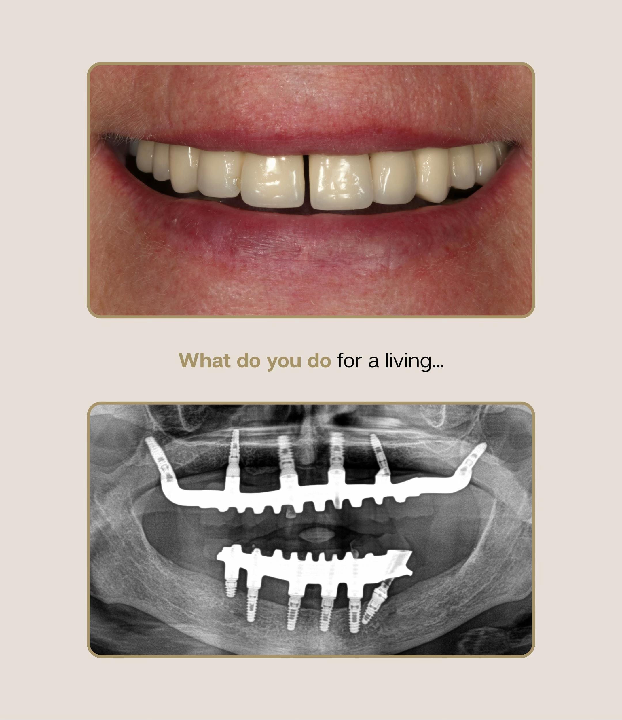Post 4 by Dentalexcellenceuk on TikTok (video)