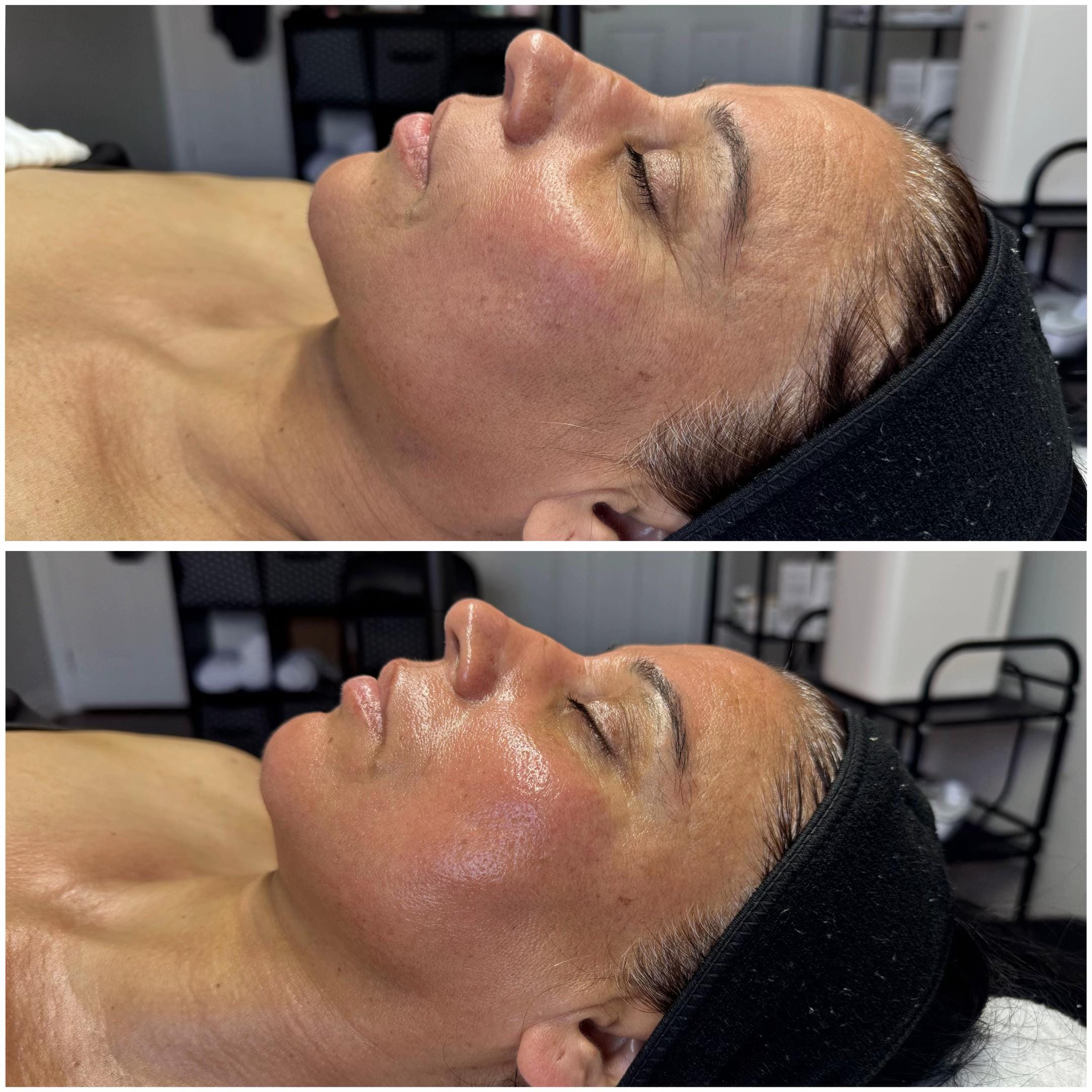 Post 6 by _timelessmedispa on TikTok (video)