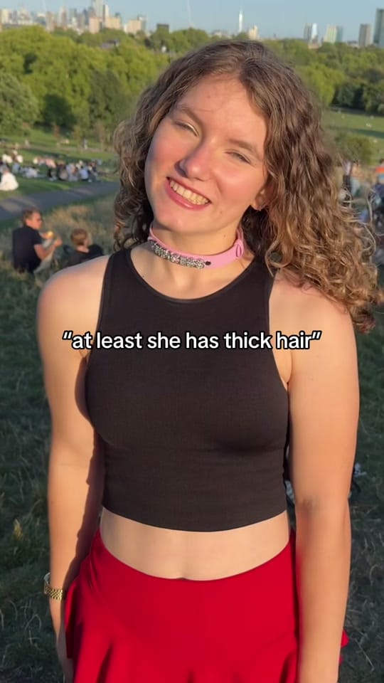 Post 5 by coco❤️‍🩹and💇‍♀️burt.the.burn on TikTok (video)