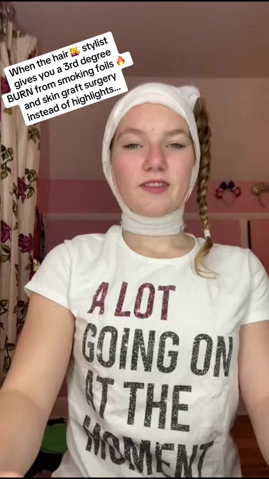 Post 10 by coco❤️‍🩹and💇‍♀️burt.the.burn on TikTok (video)