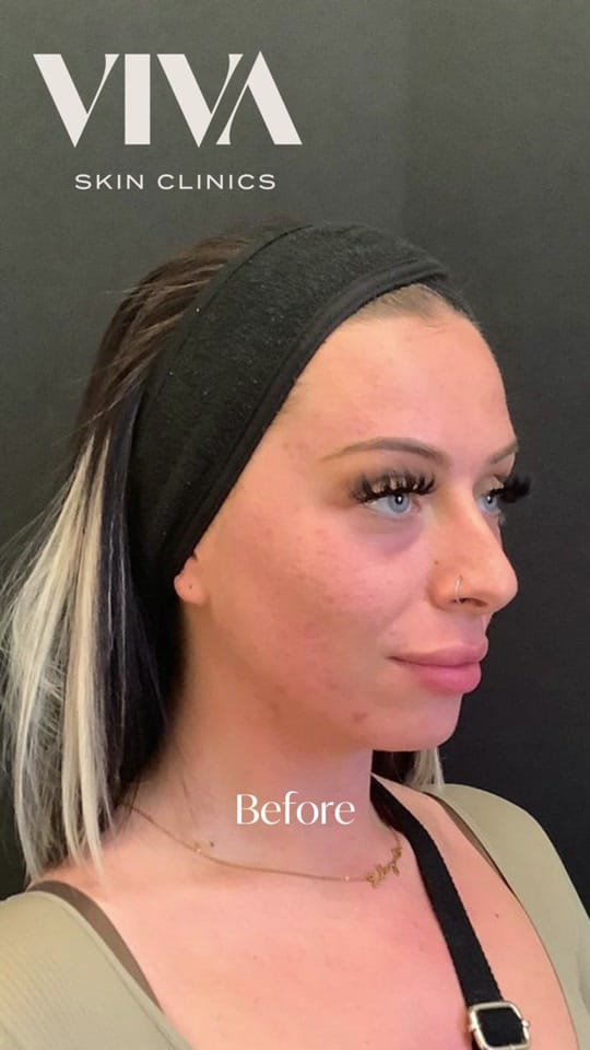 Post 10 by VIVA Skin Clinics on TikTok (video)