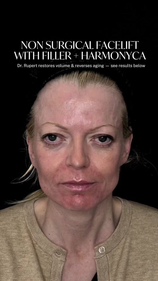 Post 2 by VIVA Skin Clinics on TikTok (video)