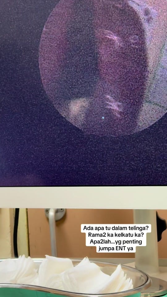 Post 7 by Dr Ikram Hakim ENT Specialist on TikTok (video)