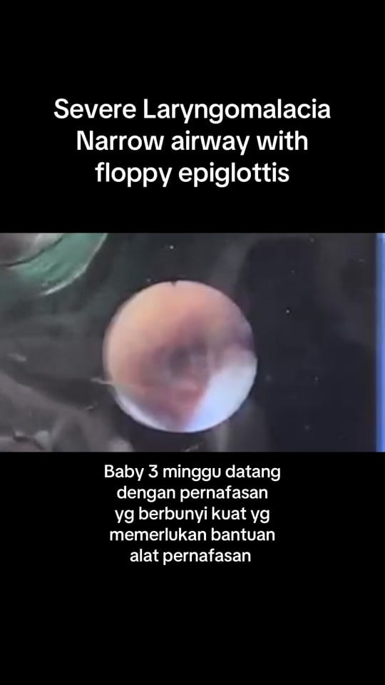 Post 8 by Dr Ikram Hakim ENT Specialist on TikTok (video)