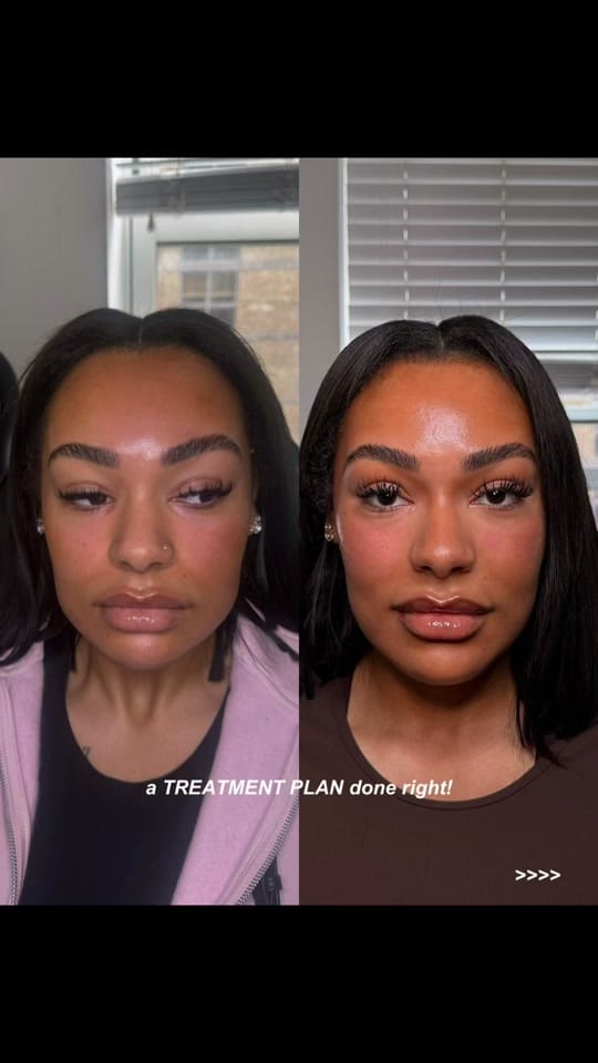 Post 8 by 15 Aesthetics on TikTok (video)