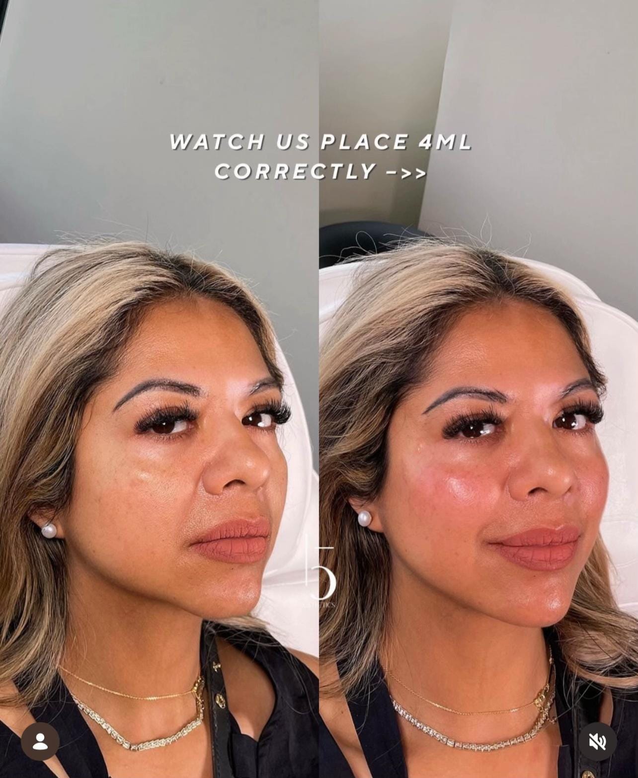 Post 3 by 15 Aesthetics on TikTok (video)