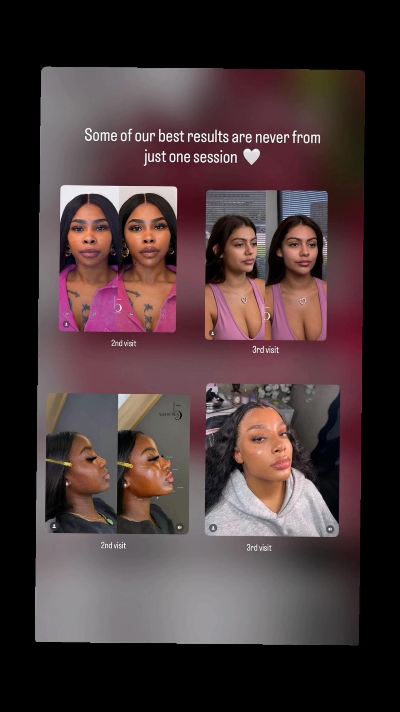 Post 6 by 15 Aesthetics on TikTok (video)