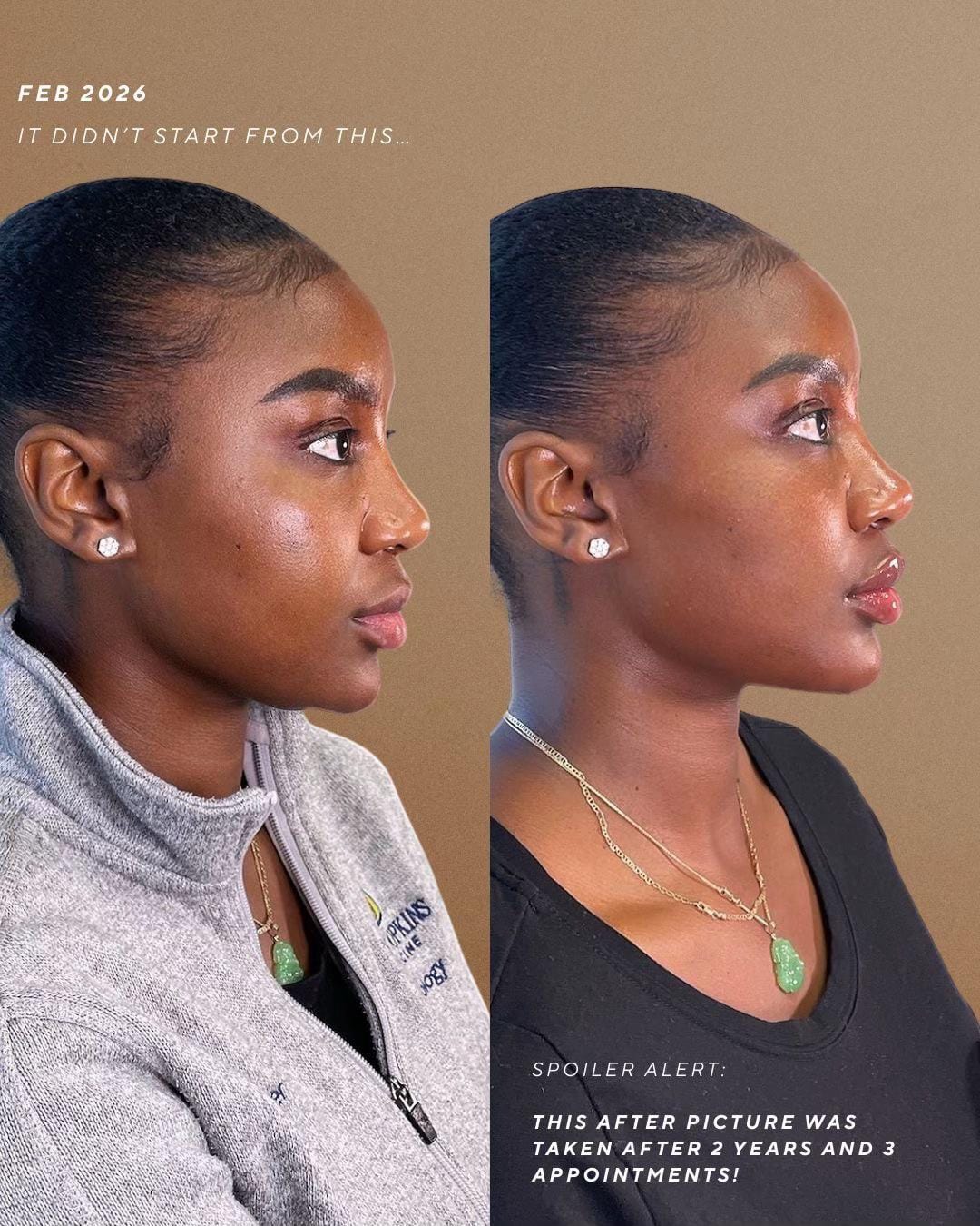 Post 9 by 15 Aesthetics on TikTok (video)