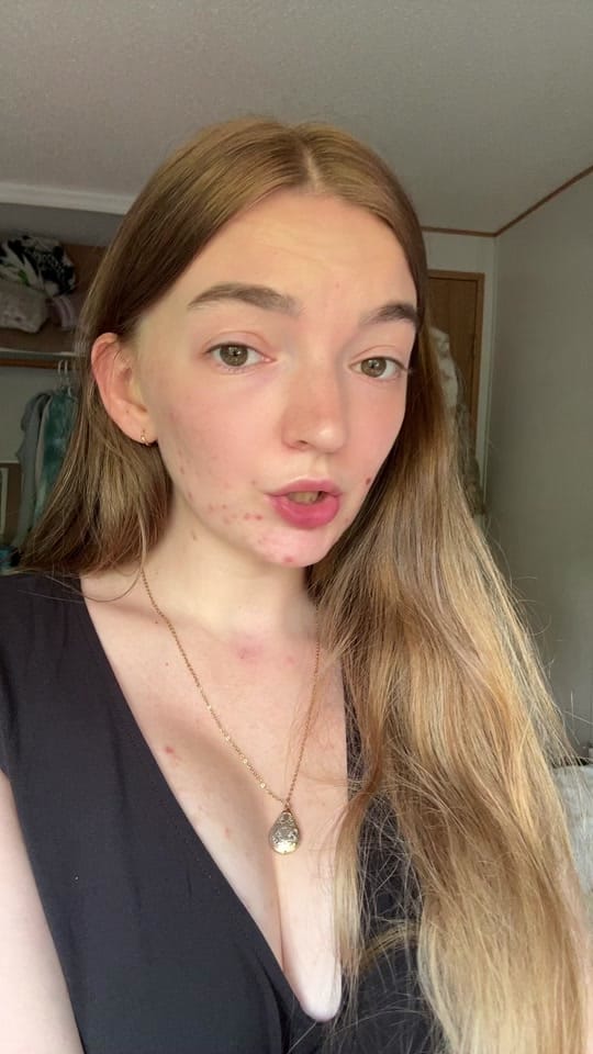 Post 8 by dev on TikTok (video)