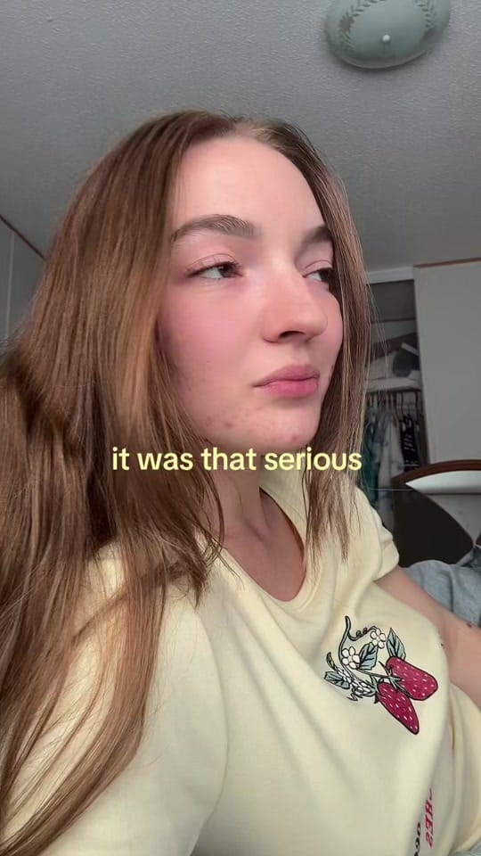 Post 7 by dev on TikTok (video)