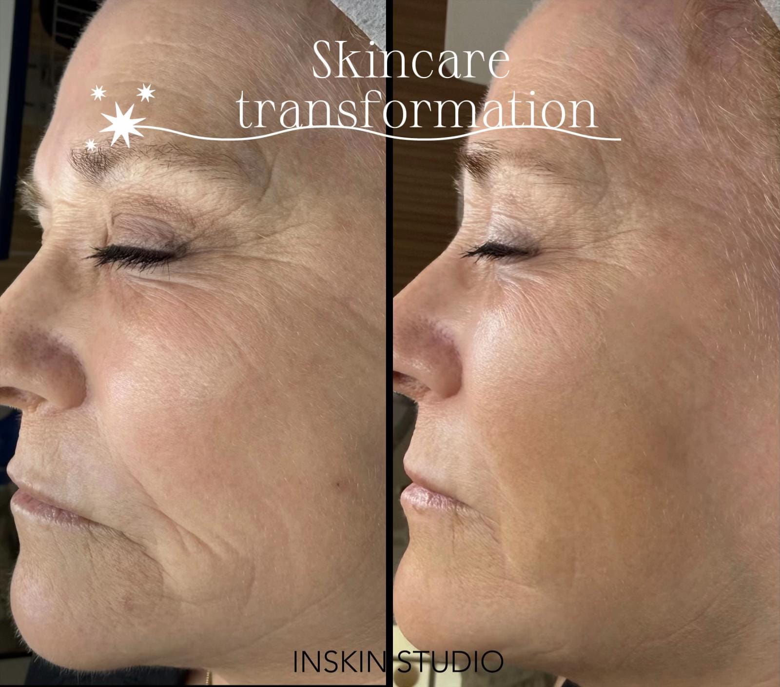 Post 3 by inskinstudio London,ON on TikTok (video)