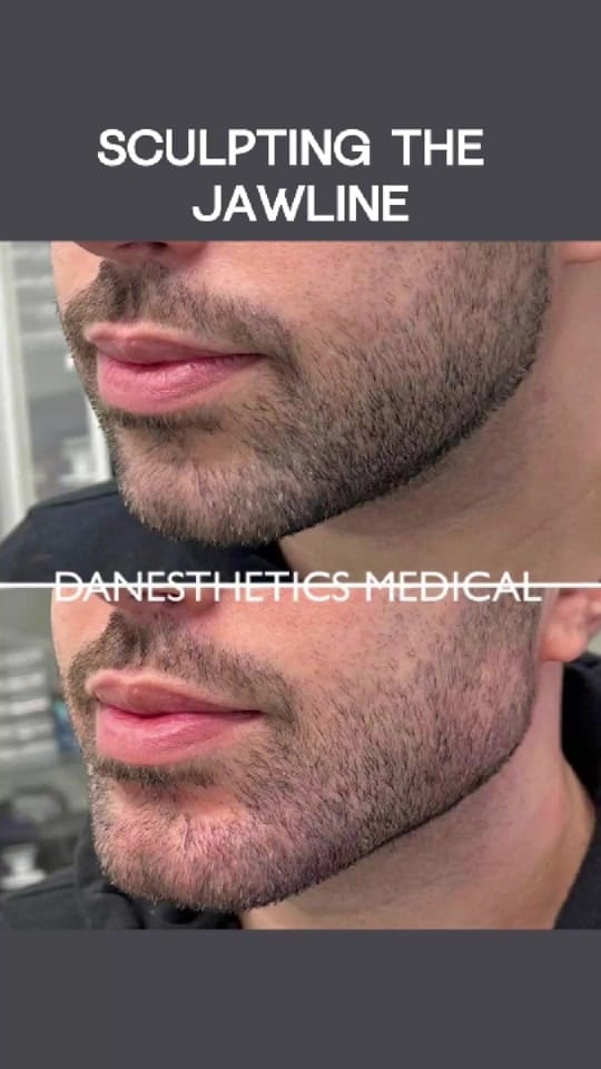 Post 2 by Danesthetics Medical on TikTok (video)