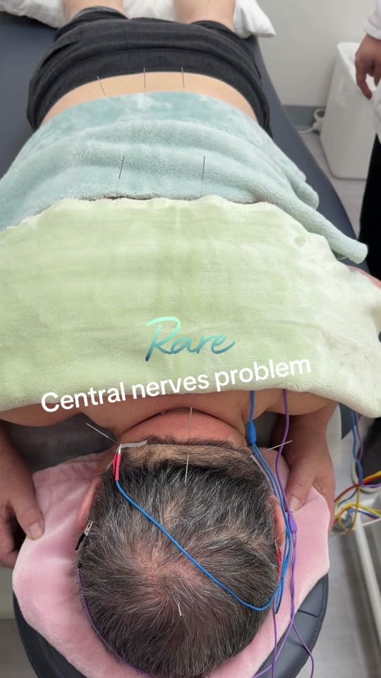 Post 6 by bridgwater_acupuncture_massage on TikTok (video)
