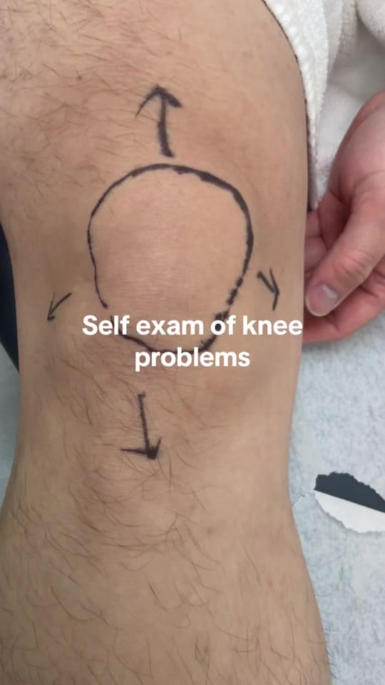 Post 4 by bridgwater_acupuncture_massage on TikTok (video)