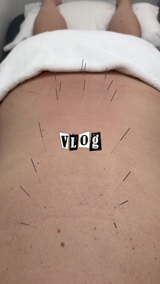 Post 7 by bridgwater_acupuncture_massage on TikTok (video)