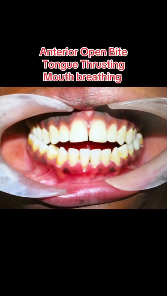 Post 2 by dokrod23 on TikTok (video)