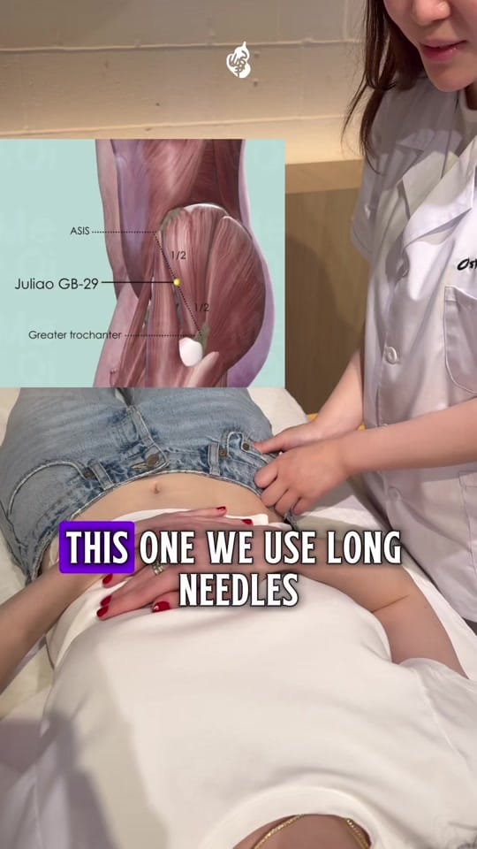 Post 4 by OsteoTuina on TikTok (video)
