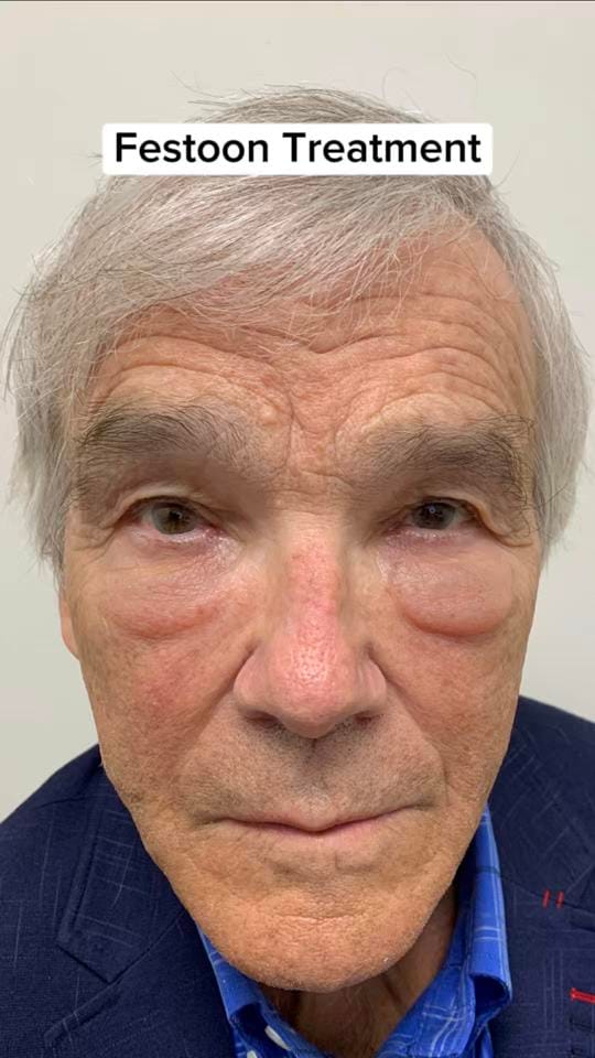 Post 8 by Dr. Babak Maleki on TikTok (video)