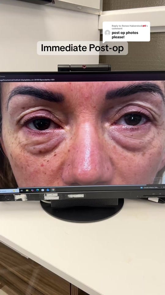 Post 4 by Dr. Babak Maleki on TikTok (video)