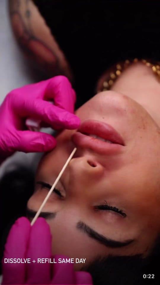 Post 9 by The Injectionist on TikTok (video)