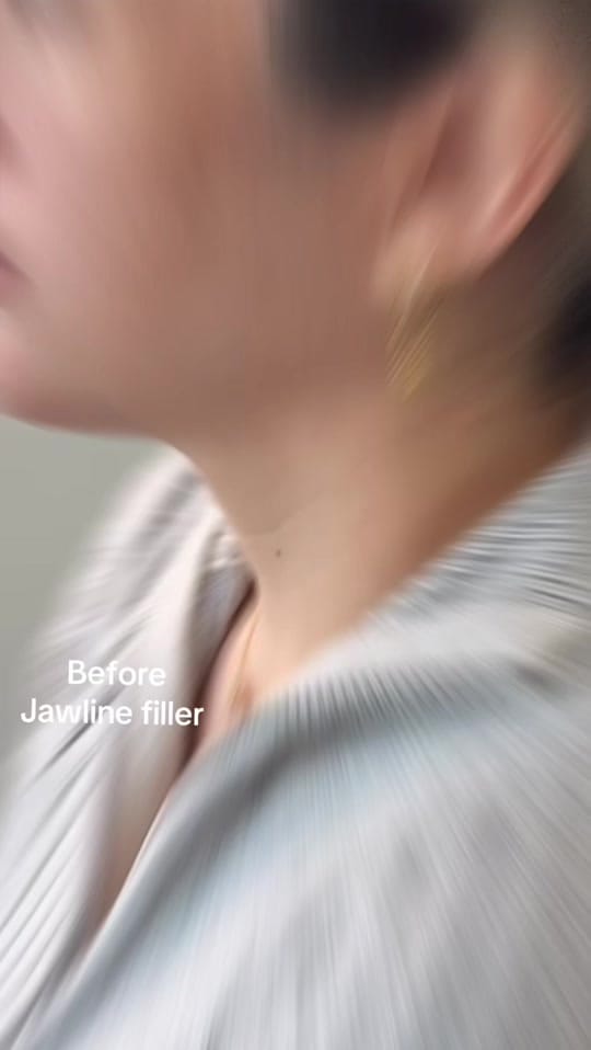 Post 10 by Nurse Jearish on TikTok (video)