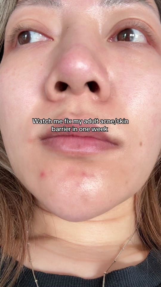 Post 6 by Suzi on TikTok (video)