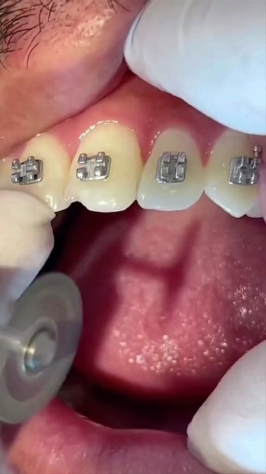 Post 1 by The Kidz Dentist on TikTok (video)