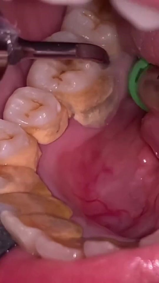Post 3 by The Kidz Dentist on TikTok (video)