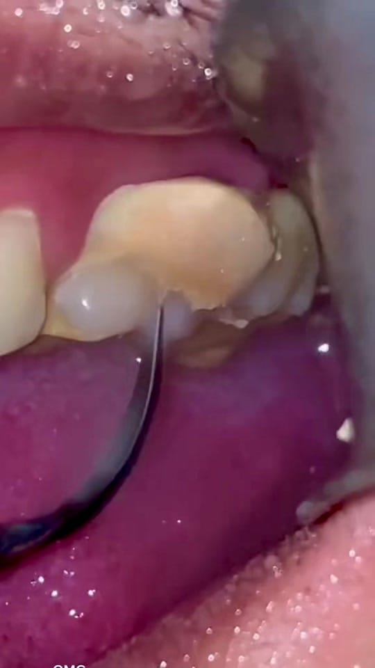 Post 6 by The Kidz Dentist on TikTok (video)
