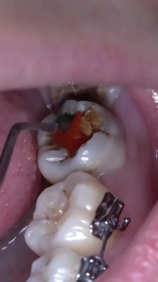 Post 4 by The Kidz Dentist on TikTok (video)