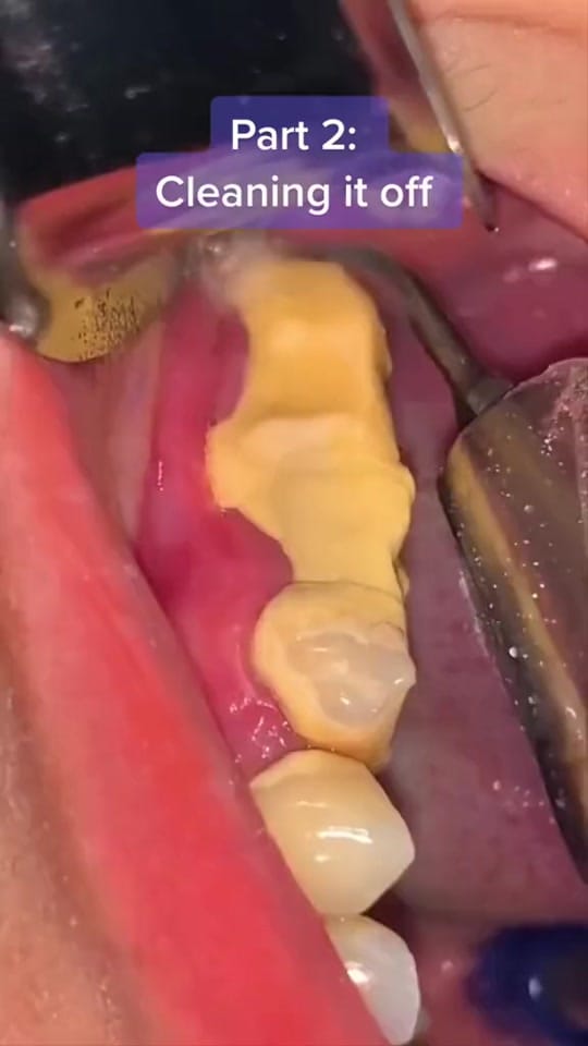 Post 10 by The Kidz Dentist on TikTok (video)