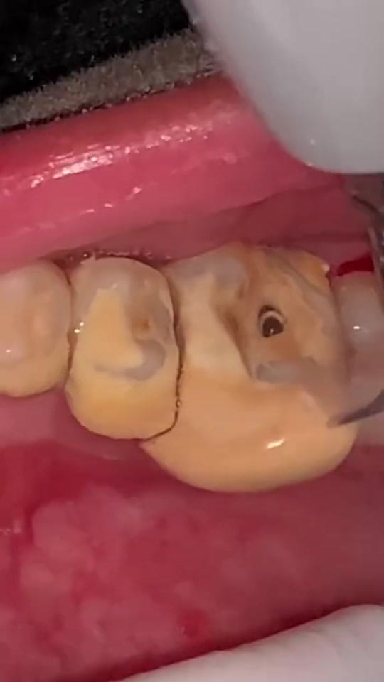 Post 5 by The Kidz Dentist on TikTok (video)