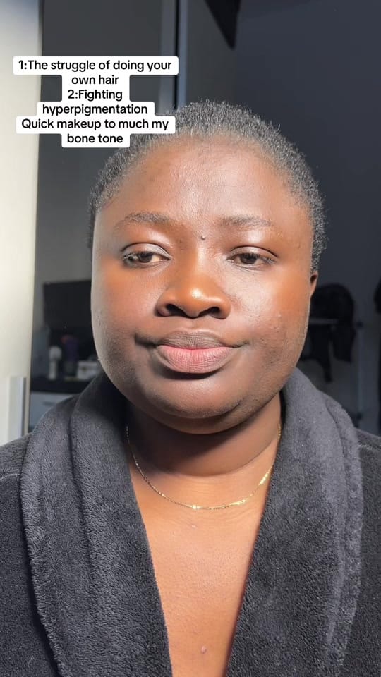 Post 3 by mylooks_beautyklinic🇩🇪 on TikTok (video)