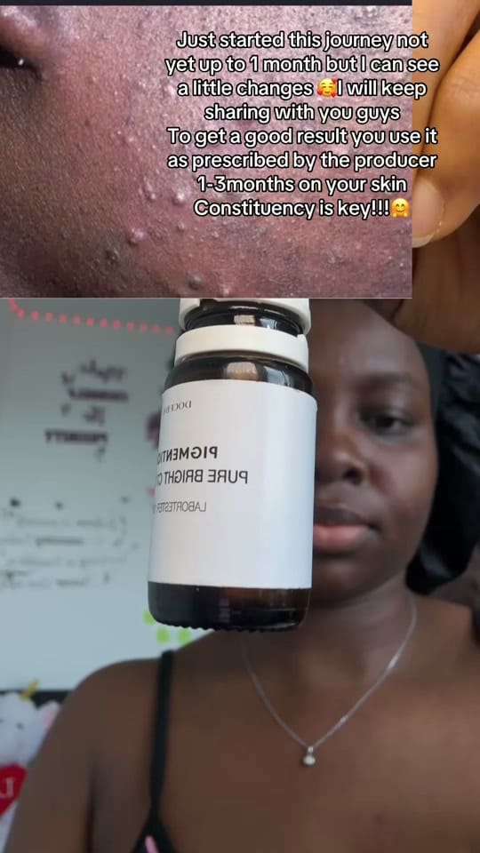 Post 2 by Joyfulnurse 🥰❤️ on TikTok (video)